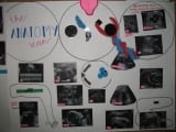 OB Project (2)