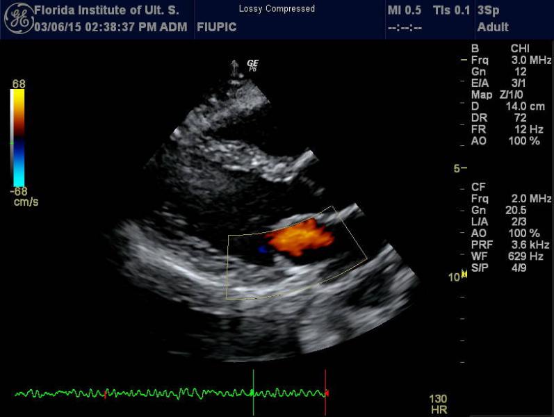 Adult Echo Ultrasound Picture.jpg